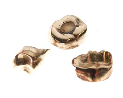 Lot 81 - Three dental gold fillings